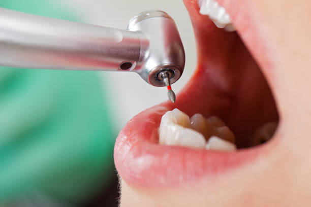 Best Urgent Care for Lost Fillings or Crowns in Three Oaks, FL